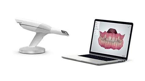 The 3Shape Trios Intraoral Scanner - Advanced Dentistry