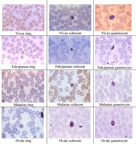 Different Stages Of Each Malaria Species Download Scientific Diagram ...