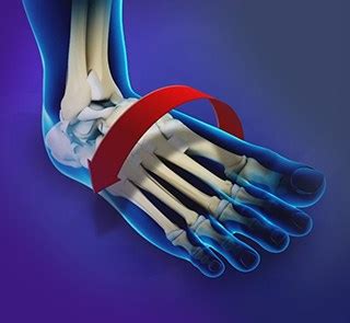 Ankle Instability Surgery Austin, TX | Ankle Instability Treatment San ...