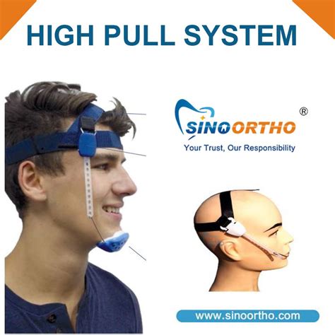 Orthodontic #highpullsystem - A high pull headgear is usually used with ...