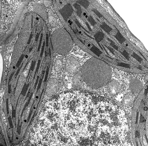 ‎Nucleus, glyoxisomes, chloroplasts, and mitochondria - magnification ...