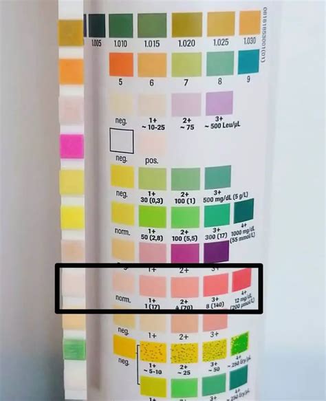 Urobilinogen in Urine: Causes and Interpretation of Results