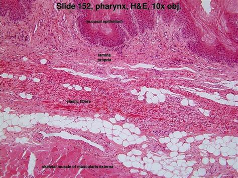 PPT - Slide 155, pharynx, H&E, 4x obj. PowerPoint Presentation - ID:5773384