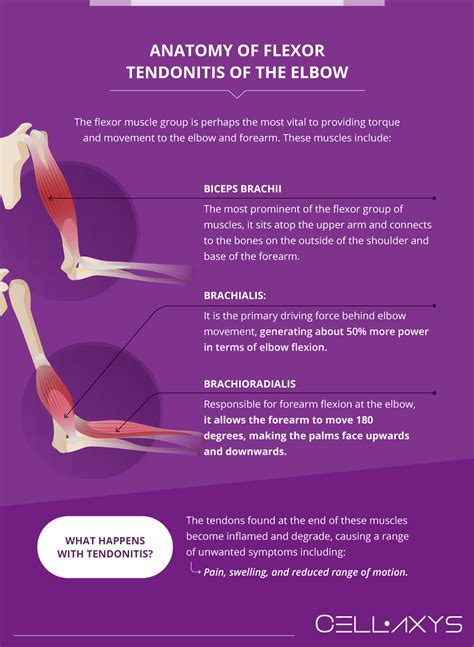 Flexor Tendonitis Of The Elbow: Anatomy, Symptoms, Causes Treatments ...