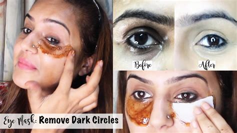 Best Under Eye Mask To Remove Dark Circles | Remove Dark Circle ...