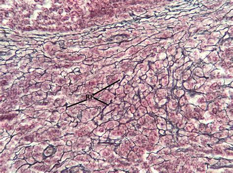 Reticular Connective Tissue 20x | Histology