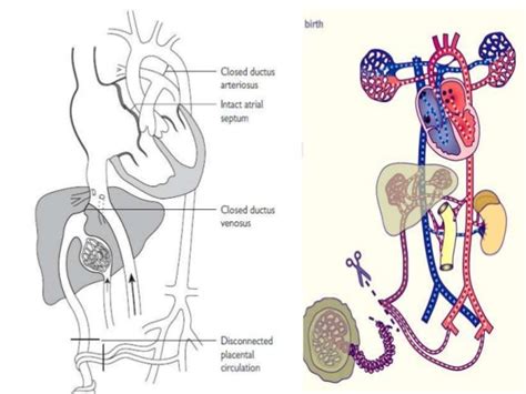 Fetal circulation & changes occurring at birth