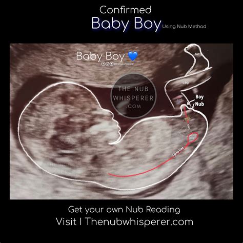 Baby boy 💙 Nub Theory | Gender prediction, Baby gender prediction ...