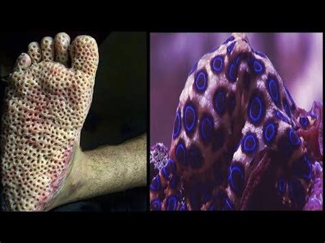 Blue Ringed Octopus Facts | Venomous Ocean Animals Mini Documentary ...