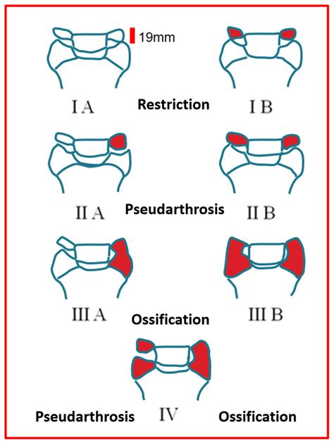 Applied Sciences | Free Full-Text | Diagnostic Limitations and Aspects ...