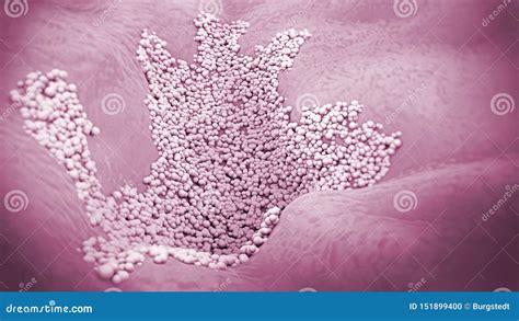 Microscopic Close-up Of A Fungal Infection Of The Upper Skin Layer ...