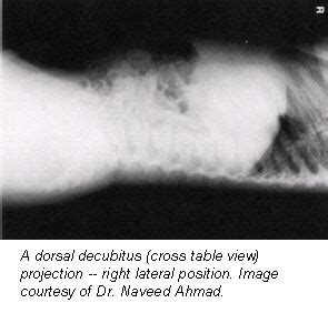 Dorsal and lateral decubitus patient positioning for abdominal x-ray ...