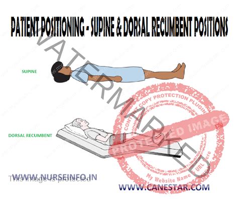 PATIENT POSITIONING – SUPINE & DORSAL RECUMBENT POSITION - Nurse Info