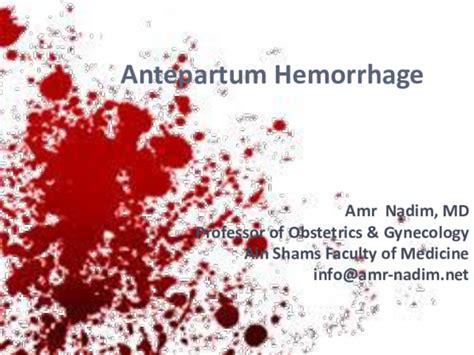 (PPT) Antepartum Hemorrhage | Amr Nadim - Academia.edu