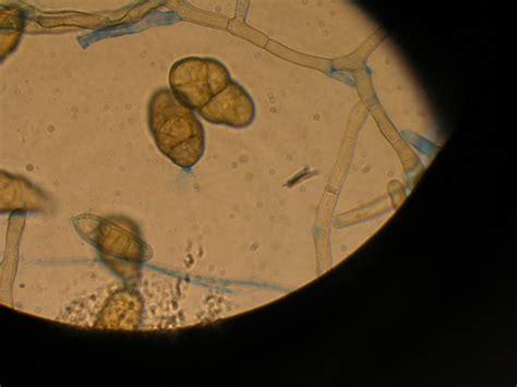 Microscopic Examination of Fungal Cultures