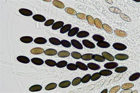 Fungal Spores Under Microscope