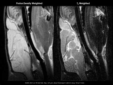 Brain Imaging - Anatomy of a Normal Rat Brain - Aspect Imaging