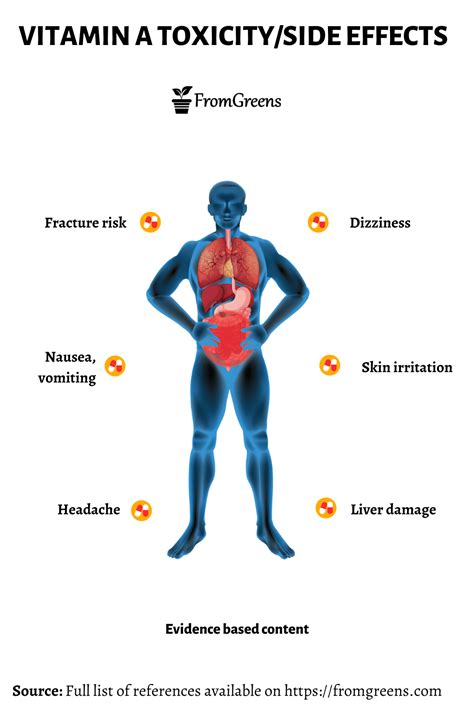 Vitamin A Toxicity Side Effects - Evidence Based Content