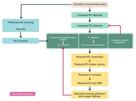 Pulmonary Embolism (PE): Causes, symptoms, diagnosis, treatment