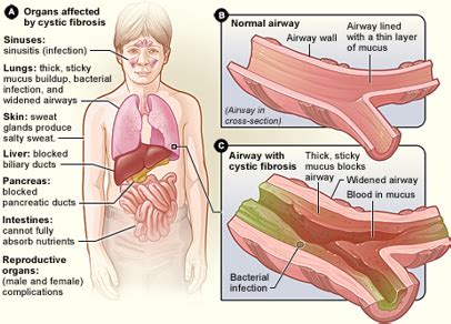 Mucous Membranes