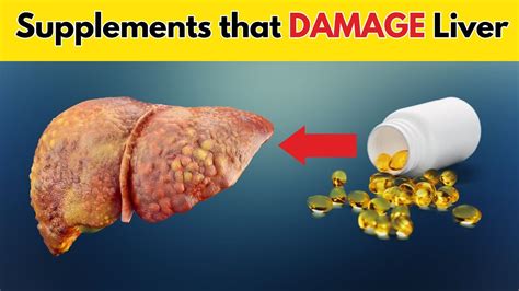 Supplements that can DAMAGE your Liver (Avoid overuse!) - YouTube