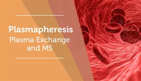 Plasma Exchange (Plasmapheresis) for MS: Procedure, Side Effects, and ...