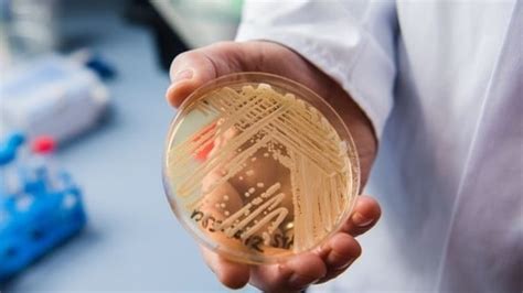 What is Candida auris? Washington state sees deadly fungal infection ...