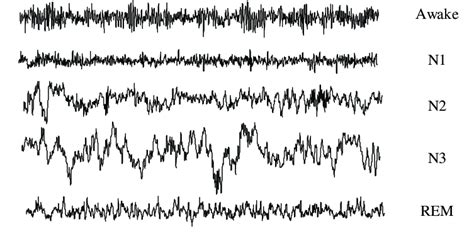 Sleep Stages Eeg Waves