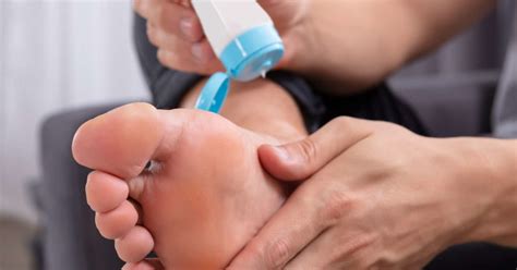 Itchy feet: 10 causes and how to get relief