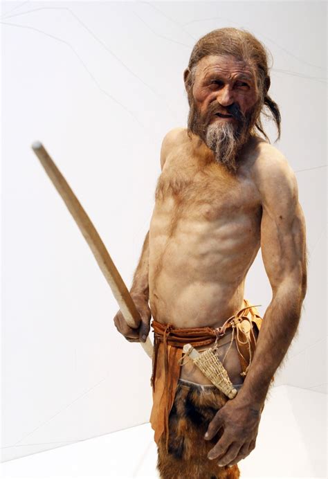 Whole Health Source: Lessons From Ötzi, the Tyrolean Ice Man. Part I