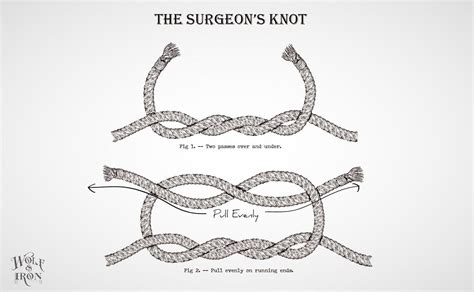 How to Tie a Surgeon’s Knot – Wolf & Iron