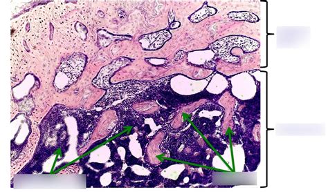 Osteon histology pt.2 Diagram | Quizlet