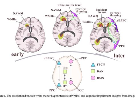 The association between white-matter hyperintensities (WMHs) and ...