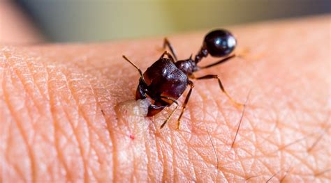 How To Treat A Black Carpenter Ant Bite - Picture Of Carpenter