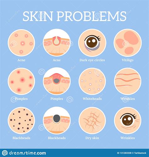 zenei Csalódás Törvényen kívüli skin issues on face fodrászat Bárki Kör