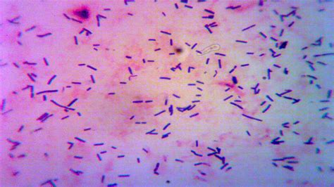 Lactobacillus Casei Gram Stain