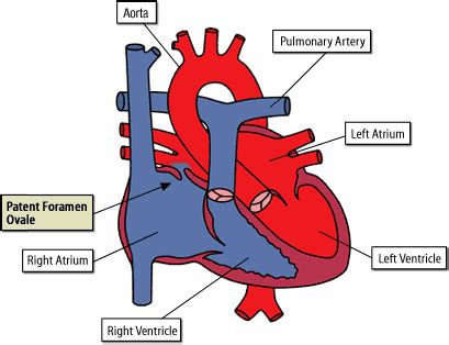 Foramen Ovale