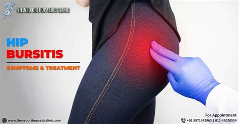 What are the symptoms of hip bursitis? - shortkro