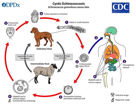 Echinococcus: Symptoms, Causes and Treatment | Healthtian