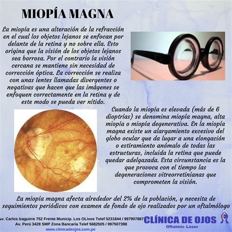 Clínica de Ojos Oftalmic Láser: MIOPÍA MAGNA