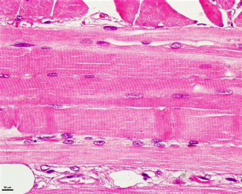 Microscopic Structure Of Skeletal Muscle