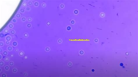 Staining Procedure of Methylene Blue Stain Archives - Medical Notes