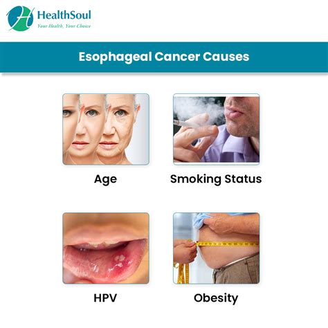 Esophagus Cancer Symptoms