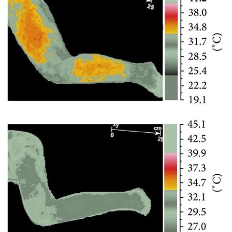 Temperature reaction measured on skin surface (short-term vasodilation ...