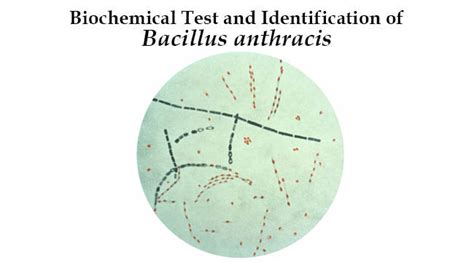 Biochemical Test and Identification of Bacillus anthracis