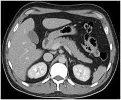 Getting Ready for Your Abdominal CT Scan | Sansum Clinic