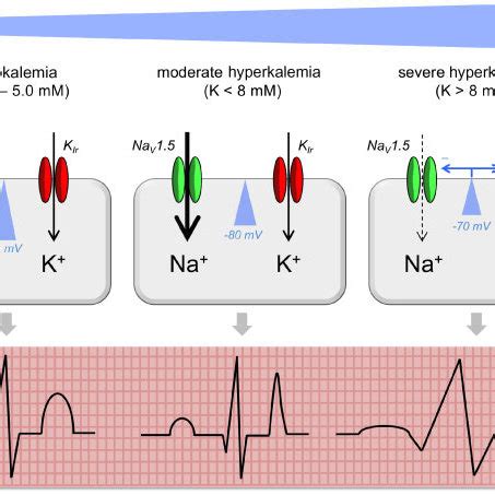 (PDF) Hyperkalemia: Pathophysiology, risk factors and consequences