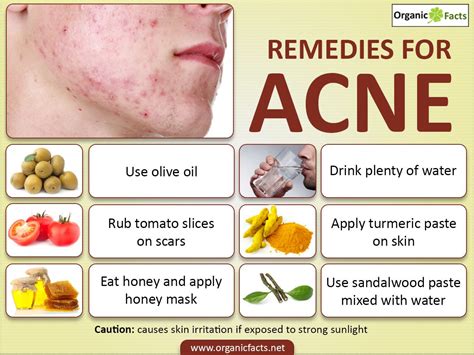 5 Home Remedies to Treat and Get Rid of Pimples | HubPages