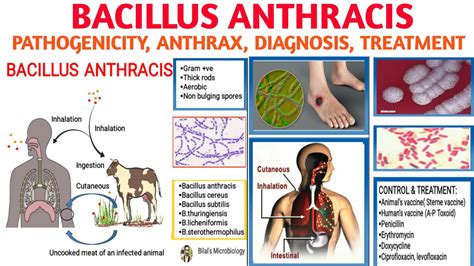 Bacillus anthracis(Anthrax) || Pathogenicity || Types of Anthrax ...