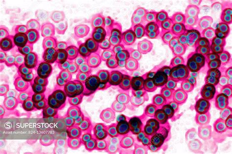 Streptococcus (Streptococcus pyogenes). Image taken from a microscope ...